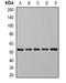 Dihydroorotate Dehydrogenase (Quinone) antibody, orb378029, Biorbyt, Western Blot image 