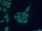 Inositol Polyphosphate-5-Phosphatase J antibody, 21417-1-AP, Proteintech Group, Immunofluorescence image 