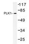 Polo Like Kinase 1 antibody, AP20264PU-N, Origene, Western Blot image 