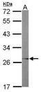 Ubiquitin Conjugating Enzyme E2 R2 antibody, PA5-31003, Invitrogen Antibodies, Western Blot image 