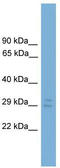 NOG antibody, TA344207, Origene, Western Blot image 