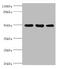 Keratin 38 antibody, A57141-100, Epigentek, Western Blot image 