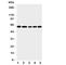 Clusterin antibody, R31357, NSJ Bioreagents, Western Blot image 