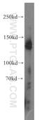 Nidogen 1 antibody, 13766-1-AP, Proteintech Group, Western Blot image 