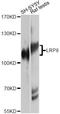 LDL Receptor Related Protein 8 antibody, A10517, ABclonal Technology, Western Blot image 