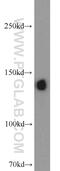 Ceruloplasmin antibody, 21131-1-AP, Proteintech Group, Western Blot image 