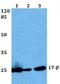 Lymphotoxin Beta antibody, A02565-1, Boster Biological Technology, Western Blot image 