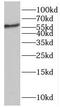 Lamin B Receptor antibody, FNab04715, FineTest, Western Blot image 