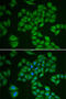 3-Hydroxy-3-Methylglutaryl-CoA Reductase antibody, 14-912, ProSci, Immunofluorescence image 