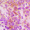 Cytochrome P450 2B6 antibody, GTX56284, GeneTex, Immunohistochemistry paraffin image 