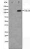 Neurotrophic Receptor Tyrosine Kinase 2 antibody, TA325756, Origene, Western Blot image 