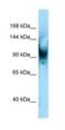 Sentrin-specific protease 6 antibody, NBP1-98428, Novus Biologicals, Western Blot image 