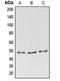 BAG family molecular chaperone regulator 4 antibody, orb214908, Biorbyt, Western Blot image 