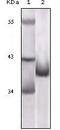 p16-INK4 antibody, MA5-17142, Invitrogen Antibodies, Western Blot image 