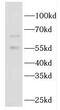 Guanylate Binding Protein 5 antibody, FNab03376, FineTest, Western Blot image 