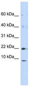 NADH:Ubiquinone Oxidoreductase Subunit C2 antibody, TA339423, Origene, Western Blot image 