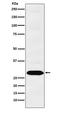Proteasome Subunit Alpha 1 antibody, M07591, Boster Biological Technology, Western Blot image 
