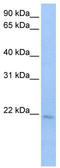 Spermatogenesis Associated 12 antibody, TA339827, Origene, Western Blot image 