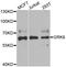 G Protein-Coupled Receptor Kinase 6 antibody, orb247403, Biorbyt, Western Blot image 