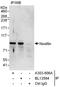 Nexilin F-Actin Binding Protein antibody, A303-806A, Bethyl Labs, Immunoprecipitation image 