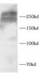 CIG antibody, FNab10458, FineTest, Western Blot image 