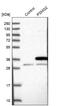 Proteasome Assembly Chaperone 2 antibody, NBP2-30576, Novus Biologicals, Western Blot image 
