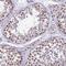 HECT Domain E3 Ubiquitin Protein Ligase 4 antibody, PA5-59413, Invitrogen Antibodies, Immunohistochemistry frozen image 
