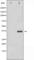 CCAAT Enhancer Binding Protein Beta antibody, abx011894, Abbexa, Western Blot image 