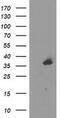 UNG1 antibody, MA5-25680, Invitrogen Antibodies, Western Blot image 