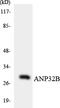 Acidic Nuclear Phosphoprotein 32 Family Member B antibody, LS-C200127, Lifespan Biosciences, Western Blot image 