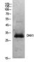 Dickkopf WNT Signaling Pathway Inhibitor 1 antibody, STJ97257, St John