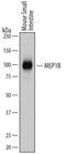 Meprin A Subunit Beta antibody, PA5-47474, Invitrogen Antibodies, Western Blot image 