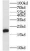 MLC-2 antibody, FNab05485, FineTest, Western Blot image 
