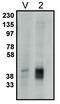 Phospholipid Phosphatase 2 antibody, MBS395992, MyBioSource, Western Blot image 