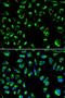 Serine/threonine-protein phosphatase 4 catalytic subunit antibody, LS-C331901, Lifespan Biosciences, Immunofluorescence image 