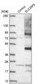 Solute Carrier Family 35 Member F5 antibody, NBP2-13334, Novus Biologicals, Western Blot image 