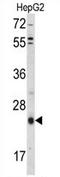 TIMP Metallopeptidase Inhibitor 3 antibody, AP54257PU-N, Origene, Western Blot image 