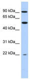 Nuclear Receptor Subfamily 1 Group D Member 2 antibody, TA334217, Origene, Western Blot image 