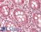 BRCA1/BRCA2-Containing Complex Subunit 3 antibody, LS-B13791, Lifespan Biosciences, Immunohistochemistry paraffin image 