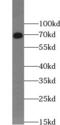 Dystrophin antibody, FNab02423, FineTest, Western Blot image 