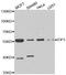 Eukaryotic translation initiation factor 5 antibody, LS-C334808, Lifespan Biosciences, Western Blot image 
