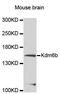 Lysine Demethylase 6B antibody, STJ114640, St John