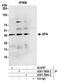 XPA, DNA Damage Recognition And Repair Factor antibody, A301-780A, Bethyl Labs, Immunoprecipitation image 