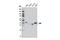 TATA-Box Binding Protein antibody, 8515S, Cell Signaling Technology, Western Blot image 