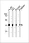 Aldolase, Fructose-Bisphosphate C antibody, LS-C204057, Lifespan Biosciences, Western Blot image 