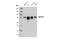 Histone acetyltransferase MYST2 antibody, 58418S, Cell Signaling Technology, Western Blot image 