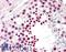 Cancer/Testis Antigen 1B antibody, LS-B11635, Lifespan Biosciences, Immunohistochemistry paraffin image 