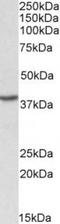 Poly(RC) Binding Protein 1 antibody, TA311355, Origene, Western Blot image 