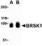 BR Serine/Threonine Kinase 1 antibody, orb74818, Biorbyt, Western Blot image 