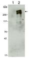 Nestin antibody, GTX30671, GeneTex, Western Blot image 